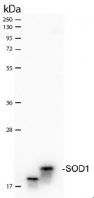 SOD1 aa 131-153 | superoxide dismutase 1, soluble in the group Antibodies Human Cell Biology / Human Oxidative Stress at Agrisera AB (Antibodies for research) (AS09 540)